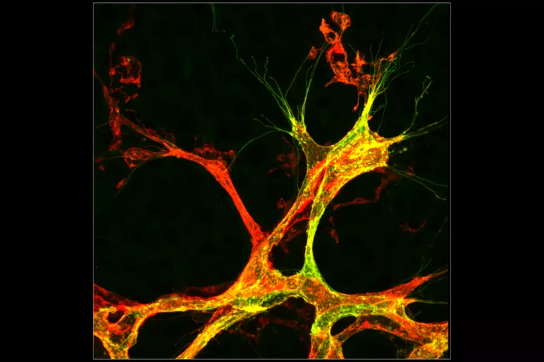 Retina Tip Cell-mTmG recombination