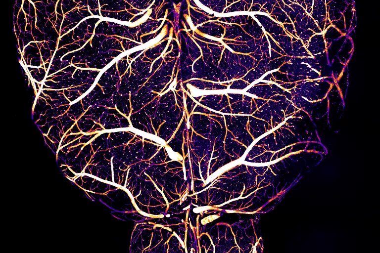 Whole Brain Vasculature